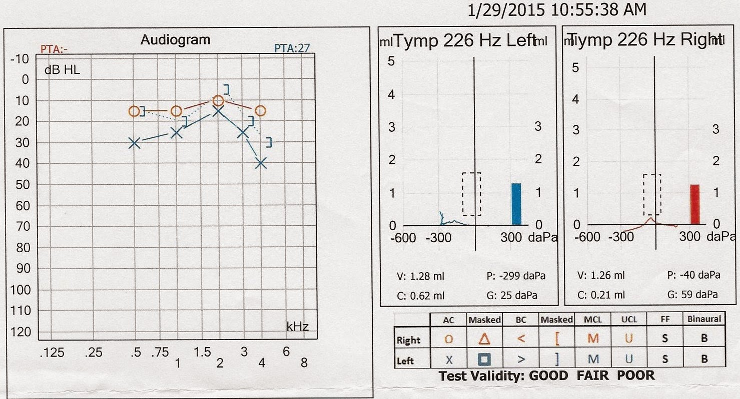 Audiology Report